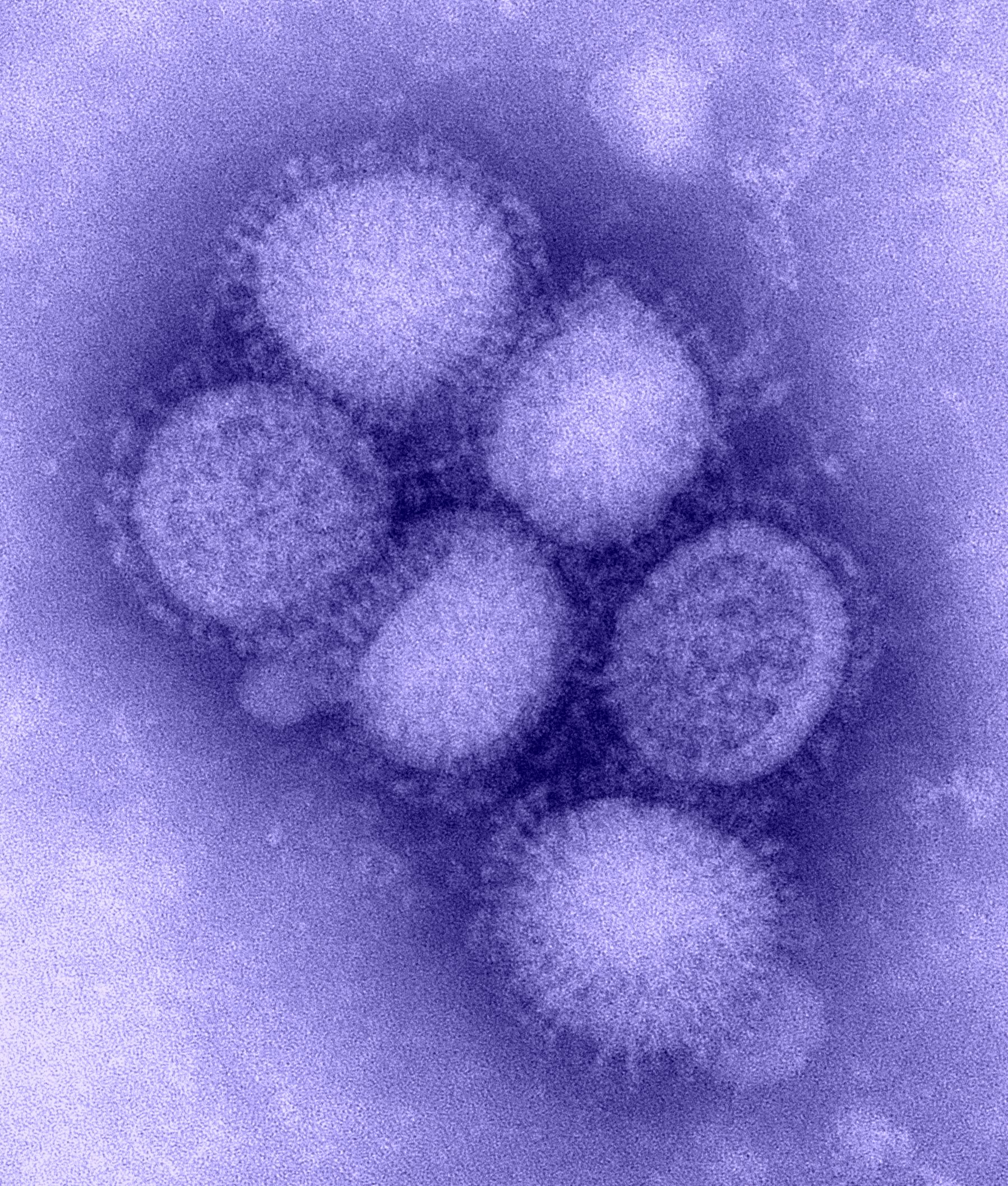 flu-h1n1-B00528-cdc