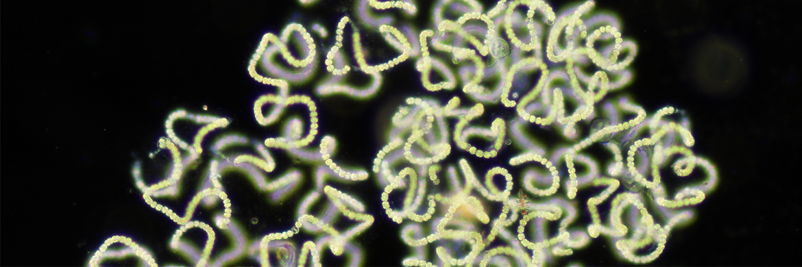 A jumble of pale yellowish-green spirals spread across the black backdrop of a microscope slide.