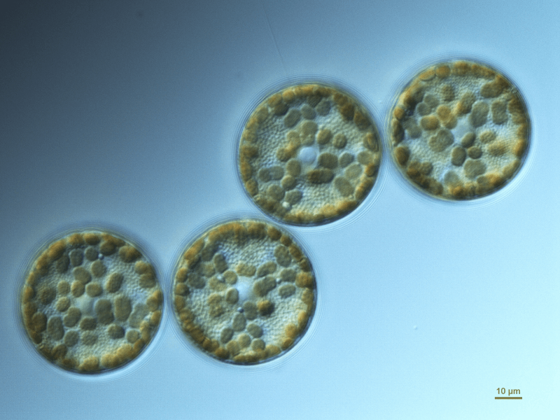 Decorative photo of the diatom Actinoptychus scenarius