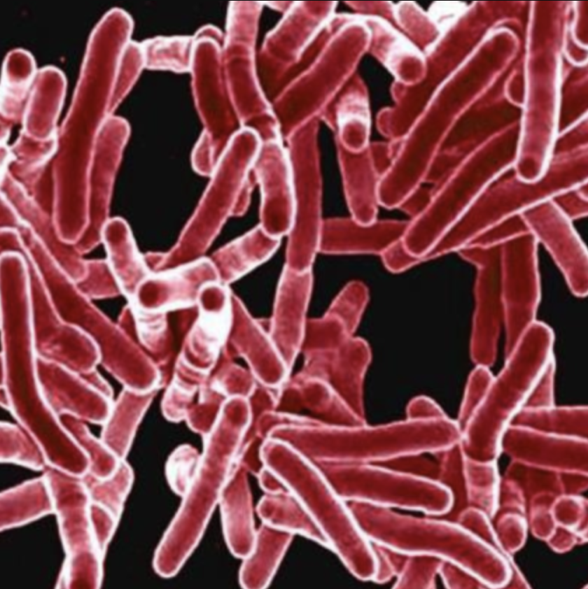 Microscopic view of tuberculosis disease