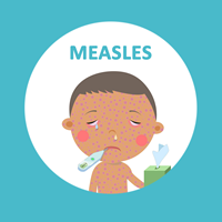 illustration of young child with measles