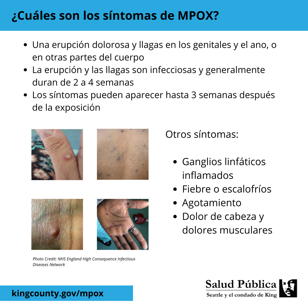 ¿Qué debo saber sobre MPOX (viruela del mono)?: Diapositiva 3